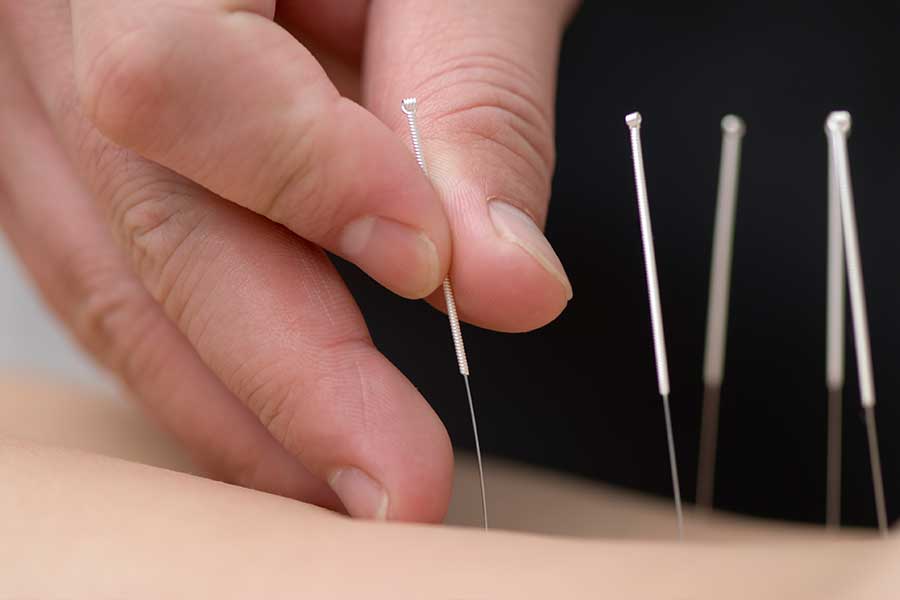 complementary therapies
