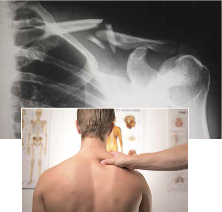 when pain persists